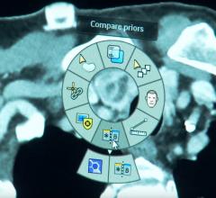 Philips’ Illumeo supports the comparison of current and prior patient images. 