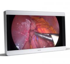 Barco Hosts Booth Talks on Medical Display Management at RSNA