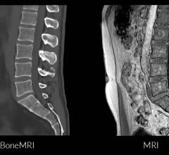 With this clearance BoneMRI is now available for the majority of relevant diagnostic MRI scanners in the US, serving radiologists, surgeons and patients