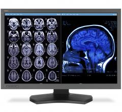Brainreader, Neuroreader, brain volume changes, degenerative brain diseases, early diagnosis
