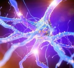 Imaging Study Shows Widespread Brain Connection Loss in Schizophrenia