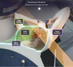 With Brainlab ExacTrac Dynamic® Deep Inspiration Breath Hold module, clinicians are able to correlate internal and external anatomy, revealing any misalignment that may otherwise remain undetected. (Source: Brainlab) 