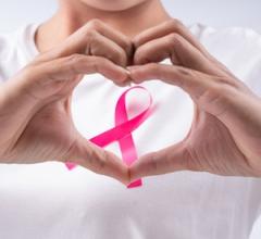 Breast cancer, dense breast, MRI