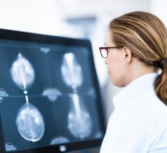 Neiman Institute Releases Breast Screening Bundle Tool