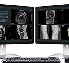 Calgary Scientific Demonstrates ResolutionMD With AI Support