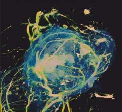 gold nanoparticles, GNP, radiation therapy boost, AAPM, Medical Physics