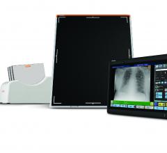 Carestream Introduces Wireless Tablet-Based DR Converter