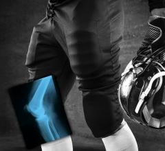 Carestream Supplies Wireless Digital X-ray Detectors for 2018 NFL Combine