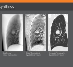 Carestream Health is partnering with Robarts Research to demonstrate the clinical value of digital tomosynthesis and dual energy technologies to help improve patient outcomes. (Graphic: Business Wire) 