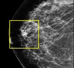 Hologic Showcases 3-D Mammography, Advanced Imaging Technologies at RSNA 2012