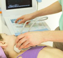 New Ultrasound Guidelines Reliably Identify Children Who Should be Biopsied for Thyroid Cancer