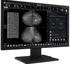 AI-based imaging solution developer PaxeraHealth has been awarded a supplier agreement with Premier, Inc. The new agreement allows Premier members, at their discretion, to take advantage of special terms pre-negotiated by Premier for Paxera’s medical imaging solutions, helping members to reduce costs and improve quality of care.