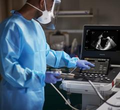 Latest iteration of Philips Compact Ultrasound System expands access to high-quality cardiac imaging at the patient bedside and beyond 