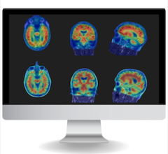 FDA Clears Cortechs.ai's NeuroQuant PET 