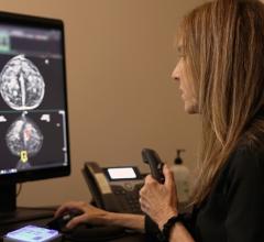 Study Shows Effectiveness of  Novel AI-Powered Breast Cancer Detection Workflow  