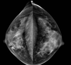 New Hampshire, breast density inform bill, January