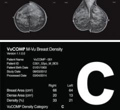 VuCOMP Mammography M-Vu Breast Density M-Vu Cad Turkey