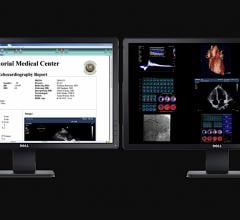 Intelerad Acquires Digisonics CVIS and OB?GYN reporting systems to Expand its Enterprise Imaging Workflow 