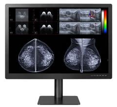 Double Black Imaging expands their line of displays for digital breast imaging with the Gemini 12MP, featuring a wizard designed specifically for MQSA testing, reporting and alerting