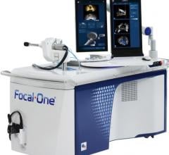 Houston Methodist Hospital Acquires Focal One High-Intensity Focused Ultrasound System