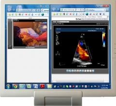 StatVideo EchoCart Telecardiology Telemedicine Cardiac Ultrasound Systems