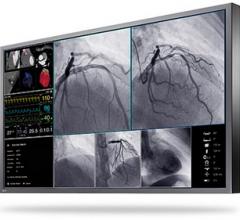 Eizo Presents a New Large-Format 4K UHD Monitor for Interventional Radiology and Endoscopy