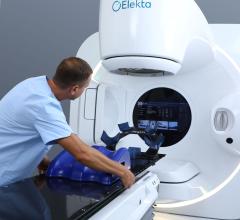 Elekta wins public tender to deliver several Harmony linear accelerators to help meet demand for cancer treatments