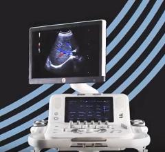 Esaote Introduces MyLab X8 Ultrasound Platform