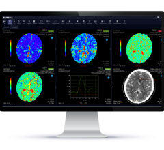 Clinically validated MR brain perfusion images support earlier diagnosis, guidance of tumor biopsies, and post-surgical monitoring 