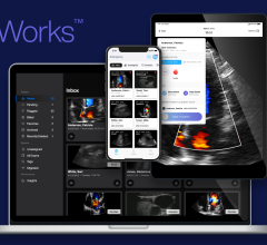 Wellstar MCG Health, Georgia’s only public academic health center, has implemented Exo Works, a point-of-care ultrasound (POCUS) workflow software from Exo, and has realized an impressive 203% rate of return on investment nine-months post implementation