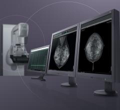 FDA Approves New Tomosynthesis Quality Control Tests for ACR Digital Mammography QC Manual