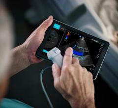 Fujifilm SonoSite Unveils SonoSite Synchronicity Ultrasound Workflow Solution