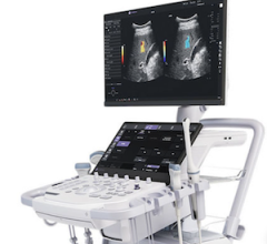 GE HealthCare Expands Ultrasound Portfolio