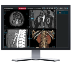 GE HealthCare to Highlight  Advanced Enterprise Imaging with Cloud-Enabled Solutions