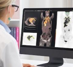 molecular imaging, gynecologic cancer