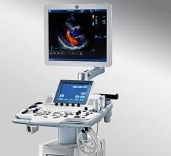 GE Vivid T8 Low Cost Cardiovascular Ultrasound