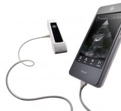 LVivo EF Cardiac Tool Now Available for GE Vscan Extend Handheld Mobile Ultrasound
