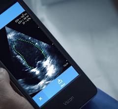 GE Healthcare Vscan with artificial intelligence (AI) automated left ventricular ejection fraction assessment with the Dia LVivo EF app. #ASE2020 #AI