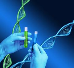 UCLA study, Oncotype Dx DCIS test, breast cancer, cost-effectiveness