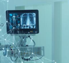 The medical imaging market size has the potential to grow by $17.64 billion during 2020-2024, and the market’s growth momentum will decelerate during the forecast period.
