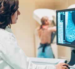 Simulation finds starting at age 30 with MRI and mammography to be the preferred strategy; starting at 25 prevented marginally more deaths, but with more testing and emotional stress