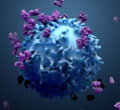 It has been estimated that the overwhelming focus on COVID-19 could cause up to 35,000 excess cancer deaths in the UK during the next 12 months, and  Zegami, the Oxford University data visualization spin-out which has worked on several projects focused on the detection, diagnosis, or management of cancer, is calling for greater use of technology to speed up the process of diagnosis and treatment.