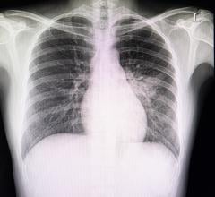 #COVID19 #Coronavirus #2019nCoV #Wuhanvirus #SARScov2