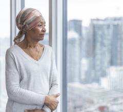 Older patients with hormone receptor-positive breast cancer who did not receive radiation therapy after breast-conserving surgery had higher rates of local recurrence but similar 10-year survival rates when compared to patients who received postoperative radiation therapy, according to updated 10-year data from the PRIME II study, presented at the 2020 San Antonio Breast Cancer Symposium