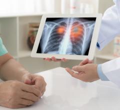 Data from Australia offers useful guidance for similar conditions in other advanced economies #lungcancer