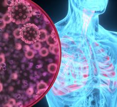 A new report from the RSNA COVID-19 Task Force addresses the impact of the epidemic on private radiology practices