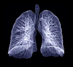 The CORAL Study will help researchers describe the clinical characteristics, treatments, biology, and outcomes of hospitalized patients with COVID-19