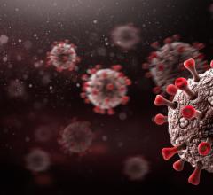 The Radiological Society of North America (RSNA) and the RSNA COVID-19 AI Task Force announced that the first annotated data set from the RSNA International COVID-19 Open Radiology Database (RICORD) has been published by The Cancer Imaging Archive (TCIA).