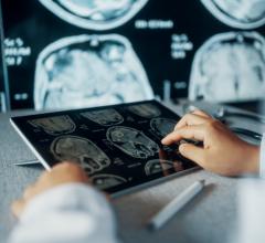 The Centers for Medicare and Medicaid Services (CMS) has released the calendar year 2022 Medicare Physician Fee Schedule (MPFS) proposed rule. The ACR has created this initial review of provisions within the MPFS proposed rule that may impact radiology or radiation oncology.