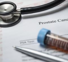 Evidence from VA medical centers nationwide supports benefits of prostate cancer screening